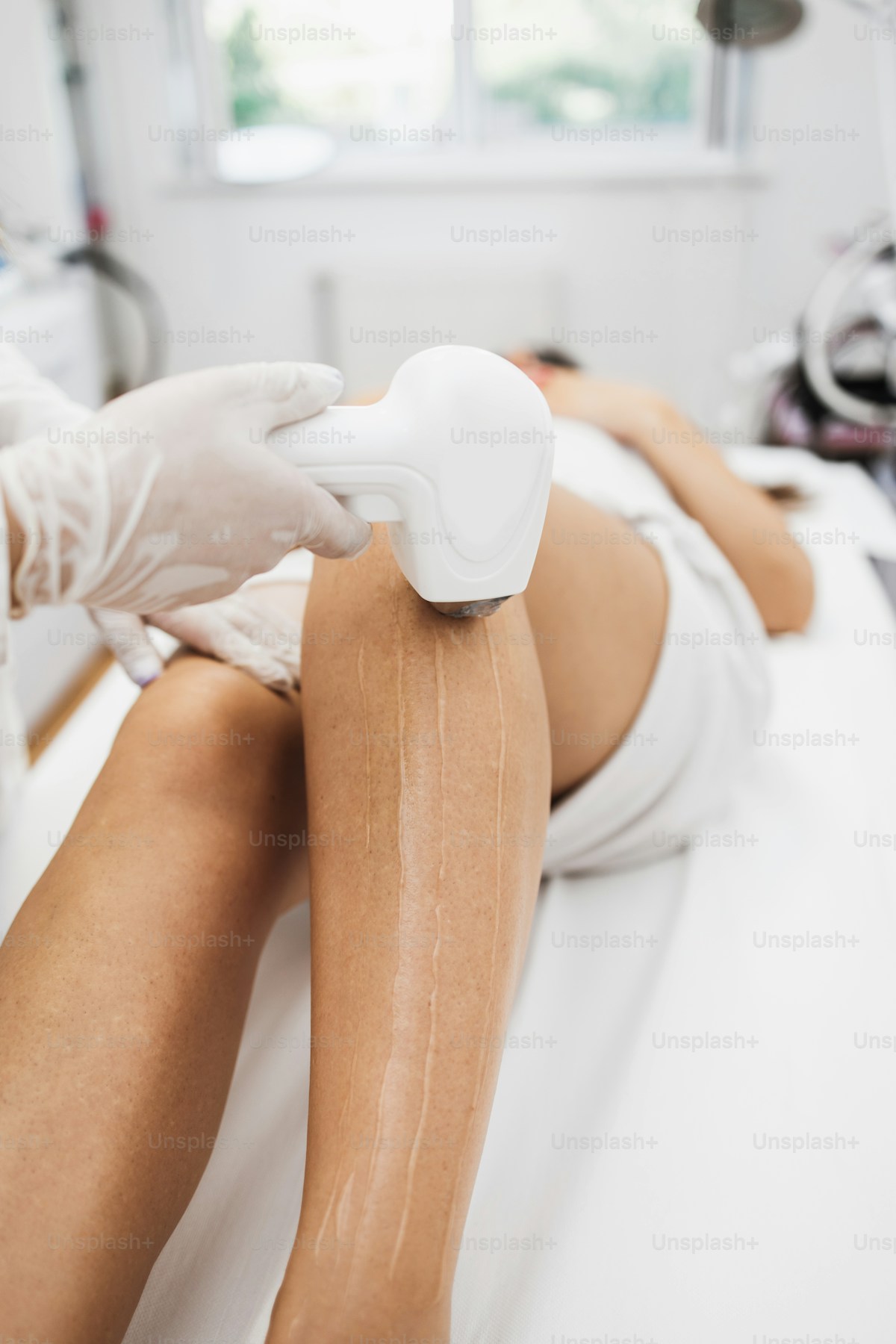 Bikini laser hair removal